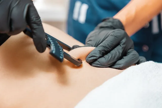 Nurse using calipers and BMI formula to determine patient's body fat