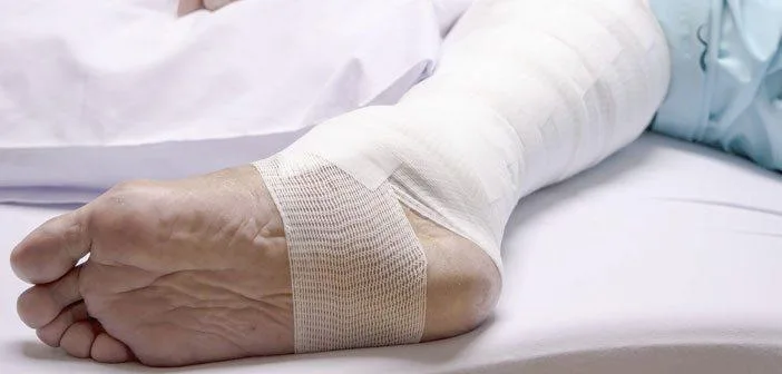 A leg with a large bandage