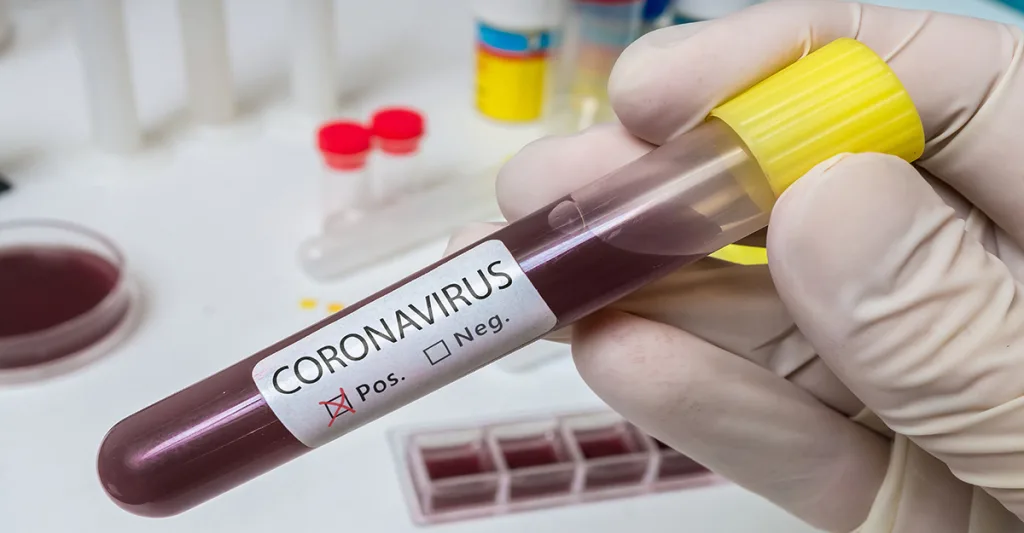 Coronavirus-test-tube-FB-GettyImages-1201511724.jpg