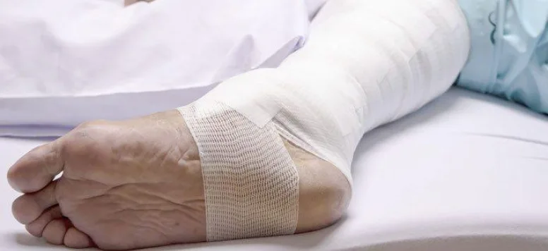 A leg with a large bandage