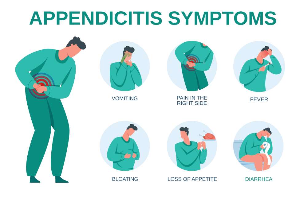 Appendicitis Symptoms