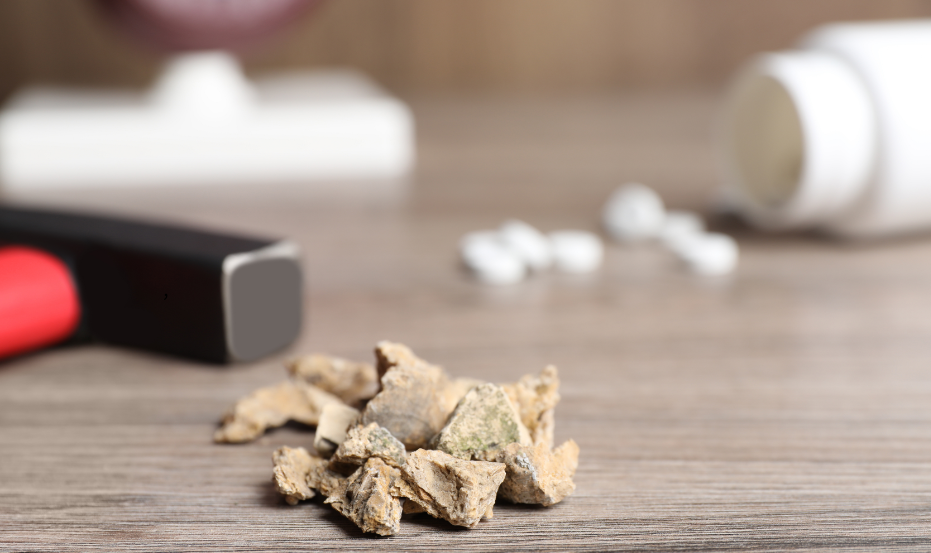 Obat Batu Ginjal di Apotek: Jenis, Fungsi & Efek Sampingnya
