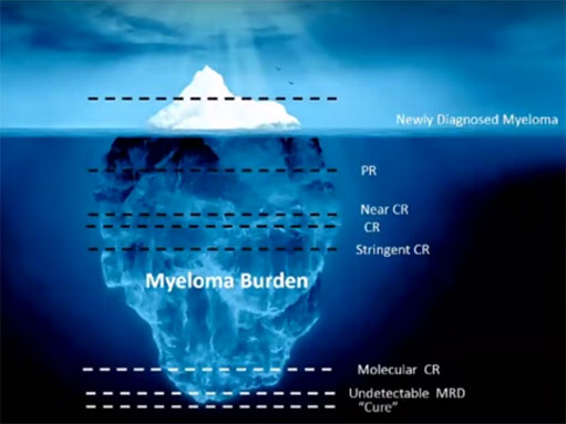 myeloma-iceberg