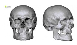 image of skull