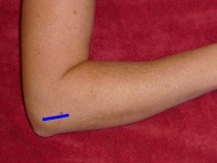 image of elbow #7