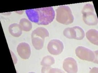 image of blood_cell