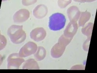 image of blood_cell