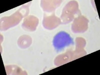 image of blood_cell