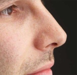 image of nose #21