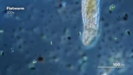 image of parasitic_flatworms