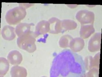 image of blood_cell