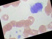 image of blood_cell