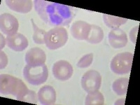 image of neutrophil