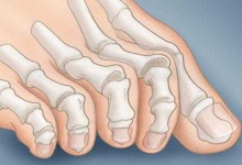image of toe #19