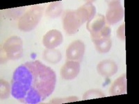 image of blood_cell