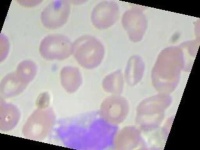 image of blood_cell