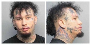 image of stitches