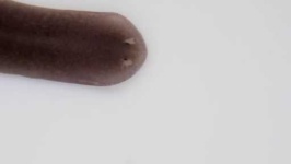 image of parasitic_flatworms