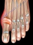 image of toe #8