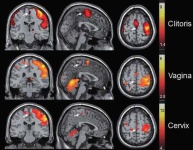 image of brain