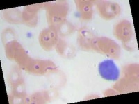 image of blood_cell