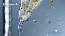 image of parasitic_flatworms