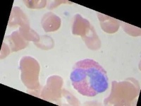 image of blood_cell