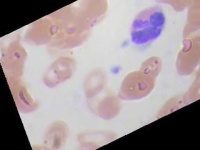 image of blood_cell