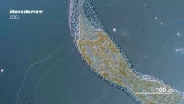image of parasitic_flatworms