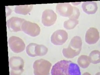 image of blood_cell