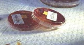 image of petri_dish