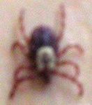 image of tick