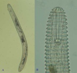 image of nematode
