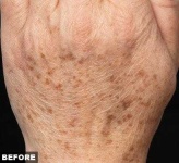 image of texture