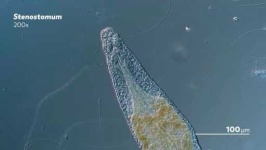 image of parasitic_flatworms