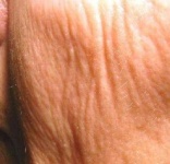 image of texture