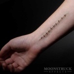 image of stitches