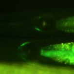 image of nematode