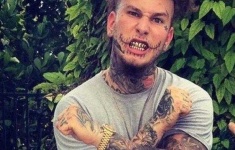 image of stitches