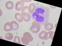 image of blood_cell