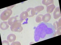 image of blood_cell
