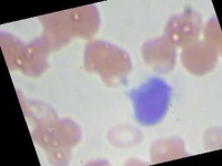 image of blood_cell