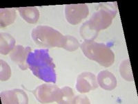 image of blood_cell