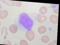 image of blood_cell