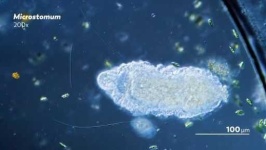 image of parasitic_flatworms
