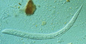 image of nematode