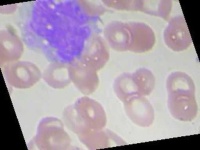 image of blood_cell