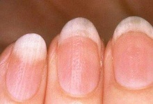 image of nail