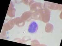 image of blood_cell