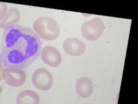 image of blood_cell